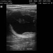 Embryo 31. den