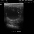embryo kolem 21.dne